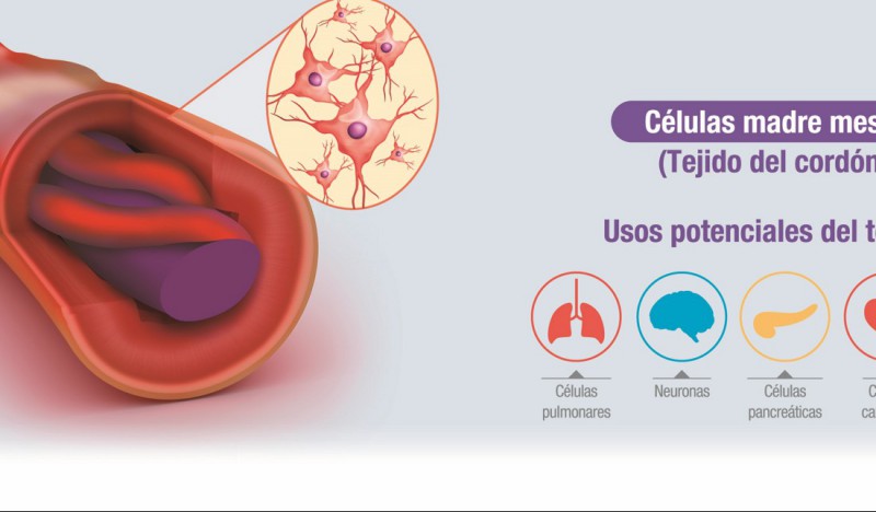 Uso De Celulas Madre Del Cordon Umbilical Consejos Celulares