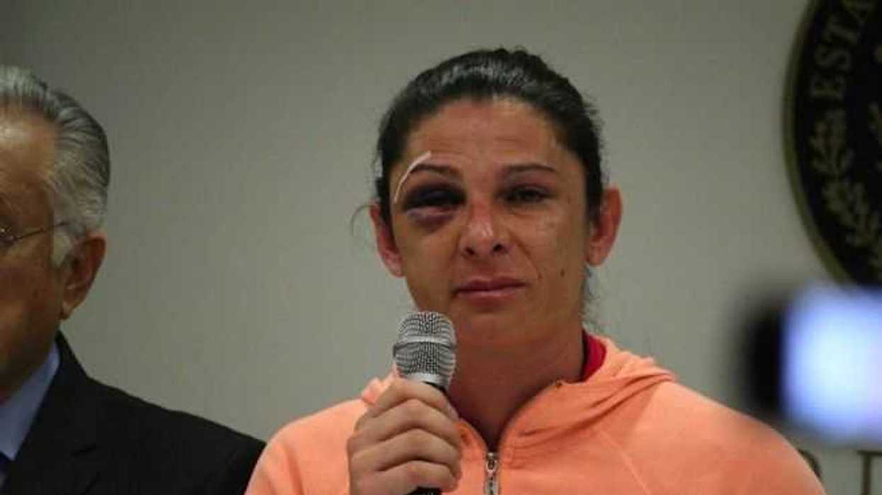 agresion-senadora-ana-gabriela-guevara