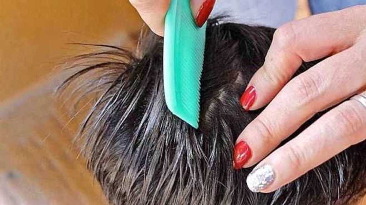 alertan-brote-de-piojos-en-colegio-de-zona-oriente-de-san-juan-del-rio