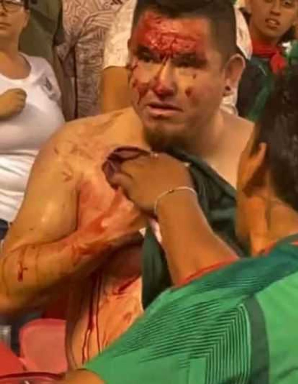 Apuñalan a aficionado tras el partido México - Qatar de la Copa Oro.