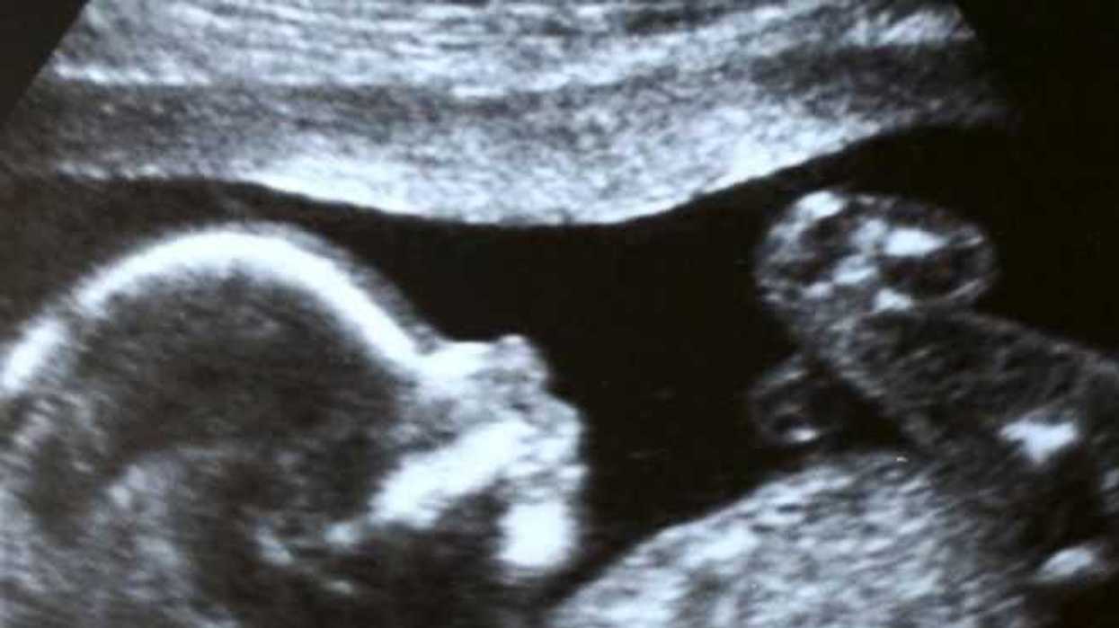 Argentina: Personal médico lanza campaña Salvemos Miles de Vidas.