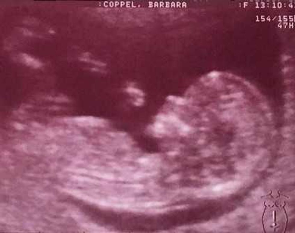Bárbara Coppel presume ultrasonido de su bebé.