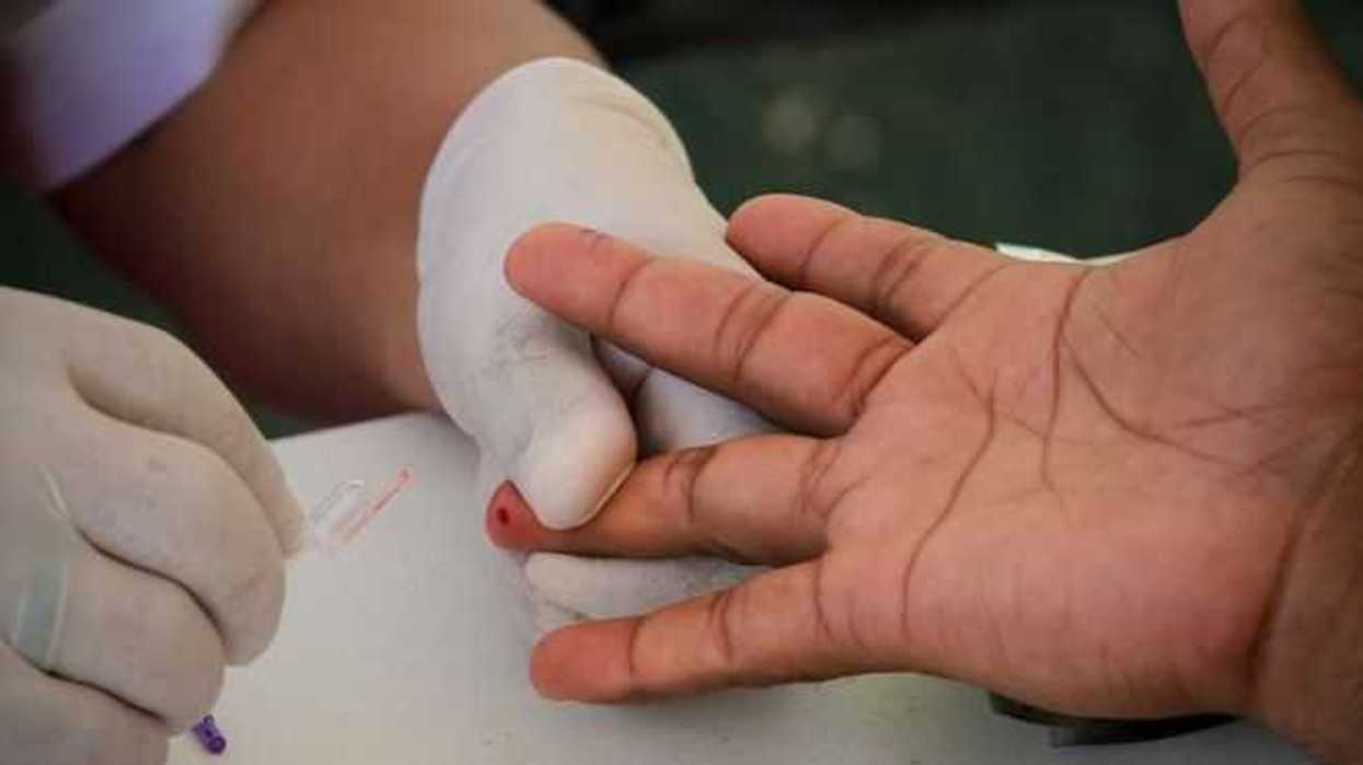 Científicos mexicanos detectan genes que afectan desarrollo del Sida.