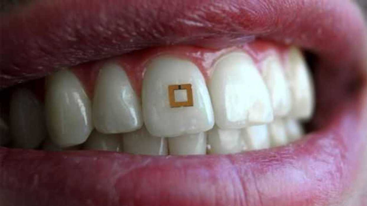 crean-nanoparticulas-para-remineralizar-dientes-y-huesos-5