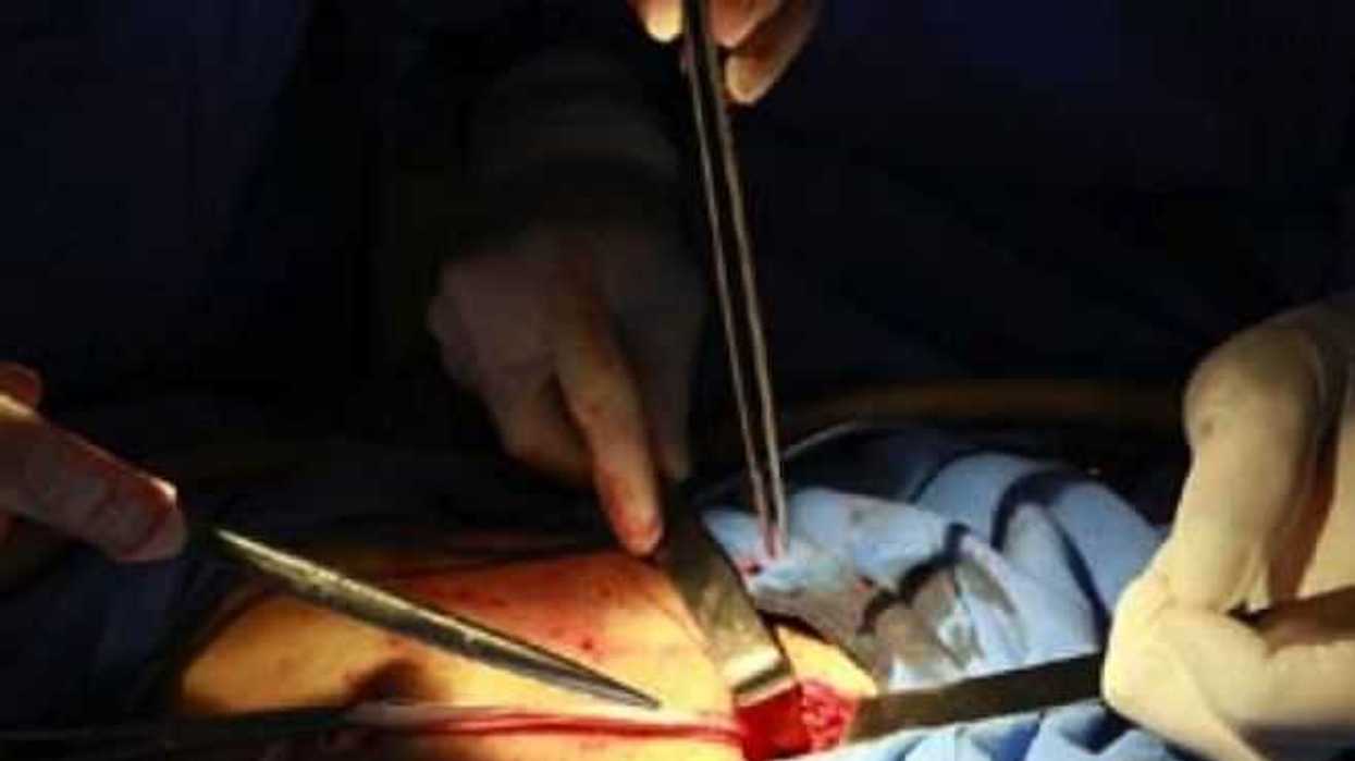 desarrollan-nuevo-metodo-esterilizar-material-quirurgico