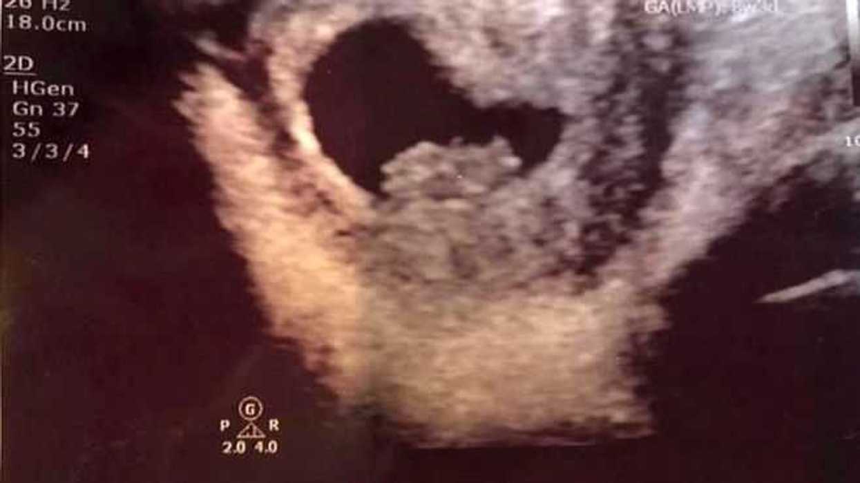 el-fallecido-rapero-xxxtentacion-sera-padre-a-titulo-postumo