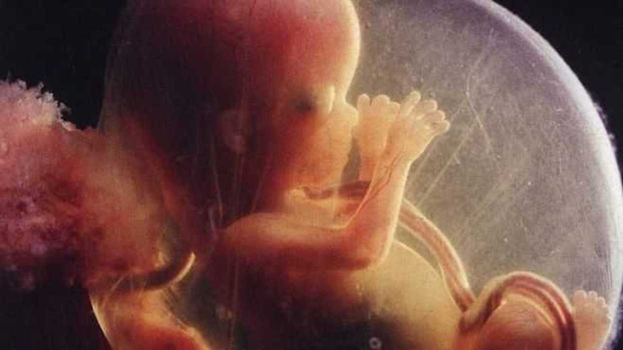 Embarazo molar ocasiona sangrado y acontece una entre mil mujeres.