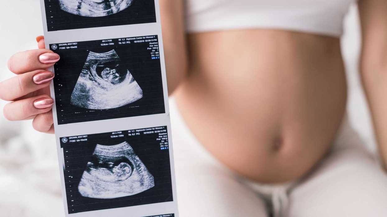 En el Senado iniciativa para acabar con la discriminación contra las mujeres por embarazo.
