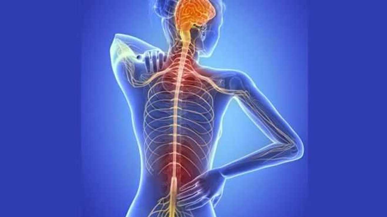 esclerosis-multiple