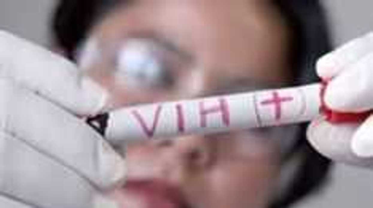 España disminuye mortalidad de personas con virus del Sida