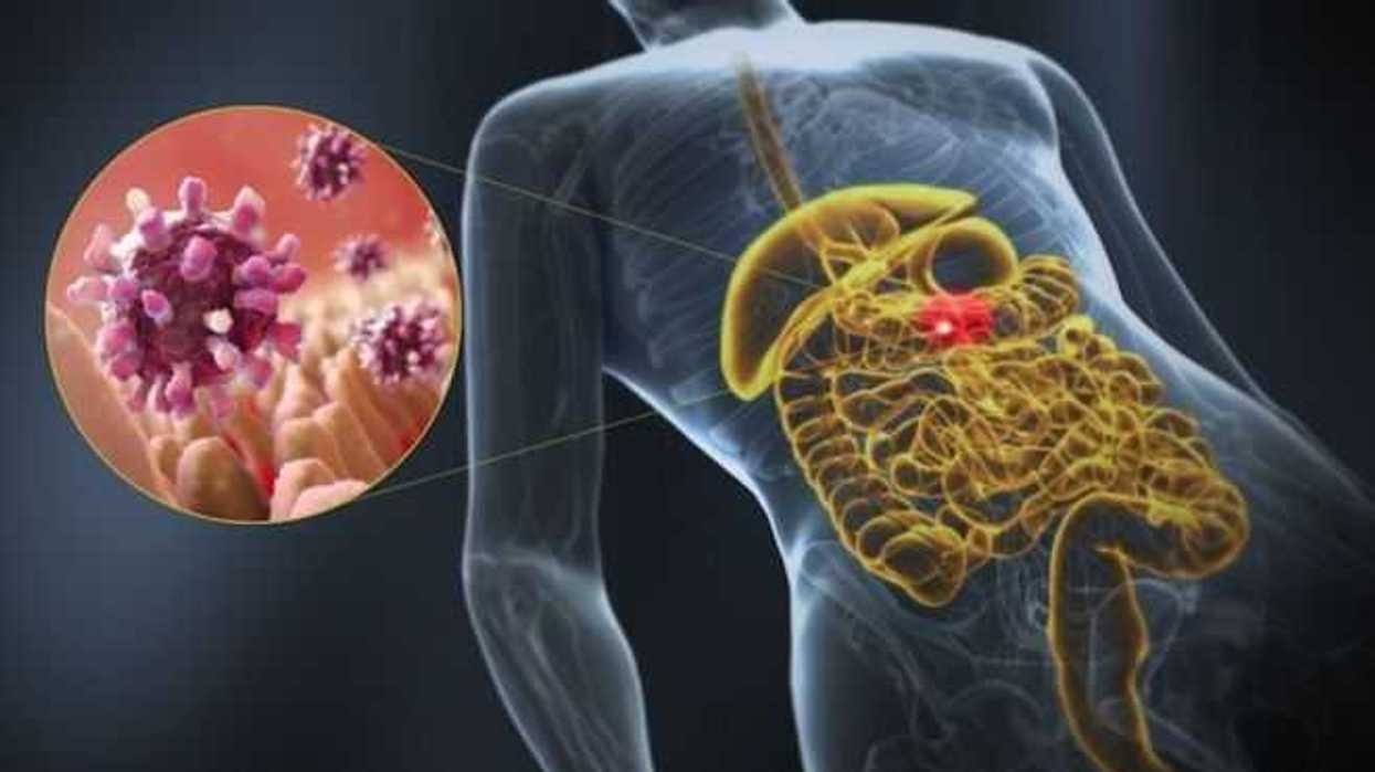 Especialista alerta sobre el calcivirus, causante de gastroenteritis.