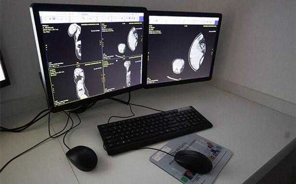 Estaci\u00f3n de trabajo con monitores que muestran im\u00e1genes de tomograf\u00eda cerebral en el IMSS Jalisco