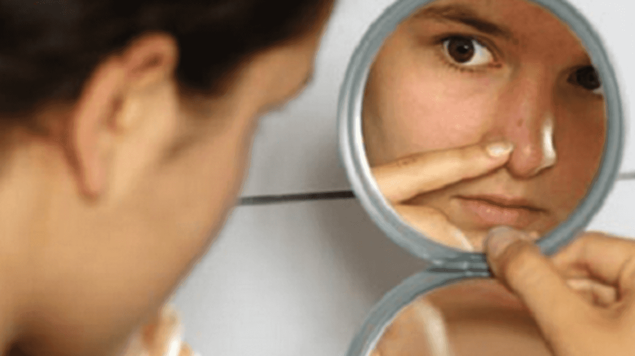 evitar pellizcar granos o espinillas