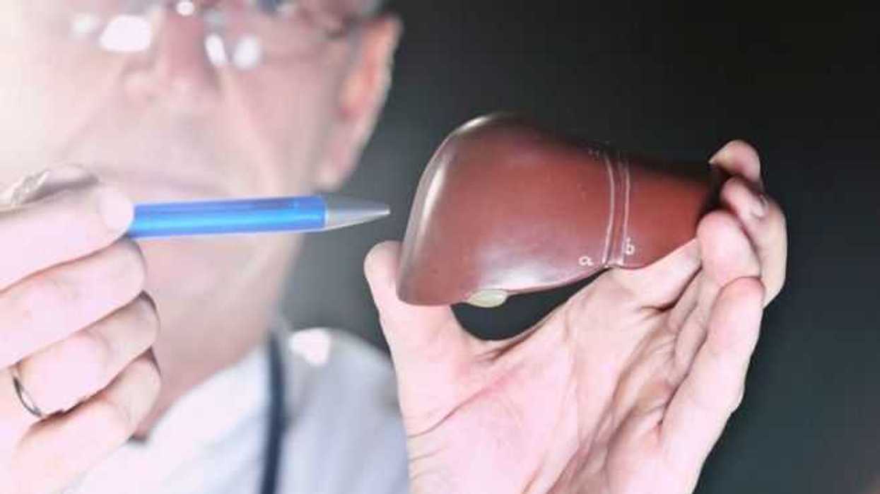 experto-del-imss-senala-causas-que-provocan-el-higado-graso