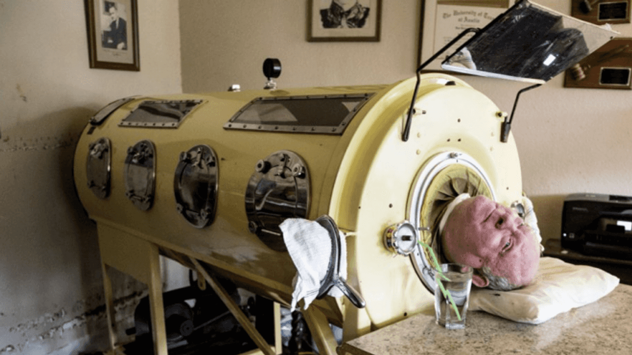 Fallece Paul Alexander, el hombre que vivió 70 años prisionero en un pulmón de acero. AGENCIA MÉXICO.