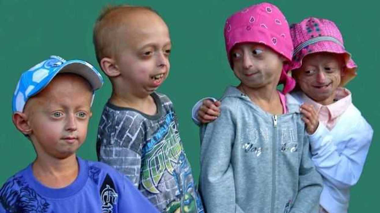 farmaco-para-cancer-demostro-beneficios-en-el-tratamiento-de-progeria