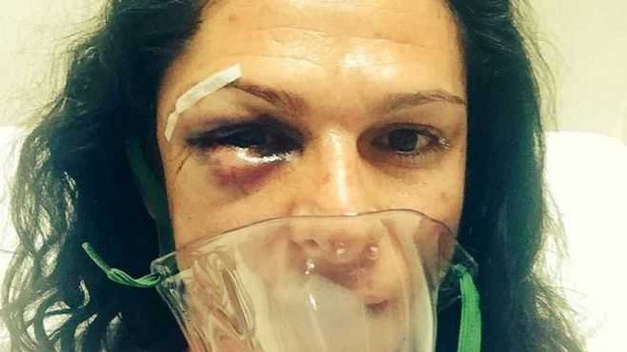 golpean-sujetos-legisladora-exdeportista-ana-gabriela-guevara