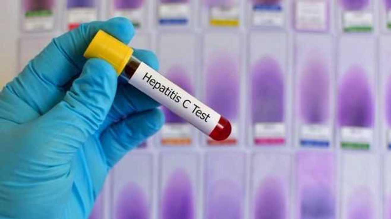 hepatitis-c-es-cada-vez-mas-frecuente-y-riesgosa