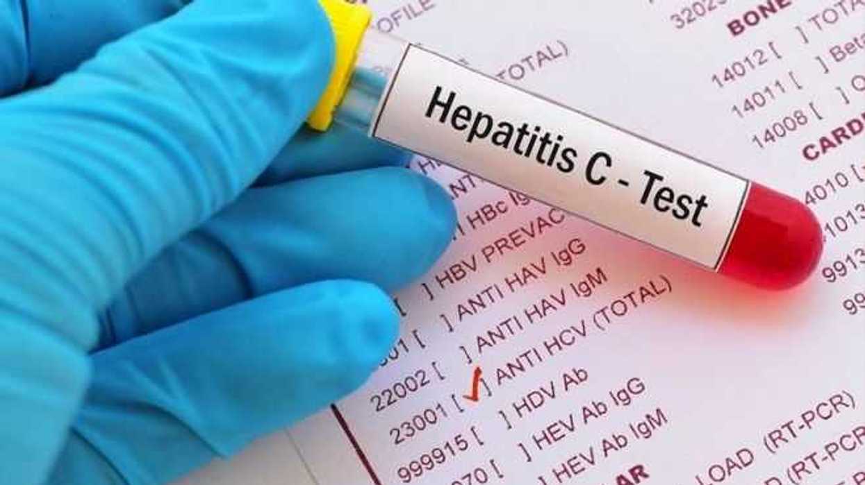 hepatitis-c-problema-de-salud-publica-que-puede-erradicarse