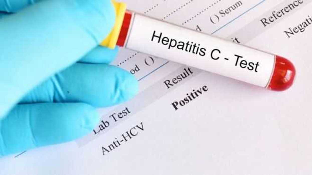 hepatitis-c-una-enfermedad-silenciosa-con-danos-irreversibles