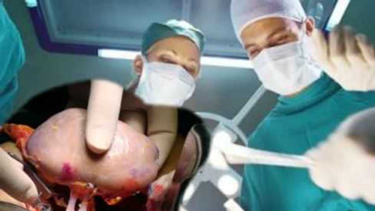 Importancia de transplante de organos.