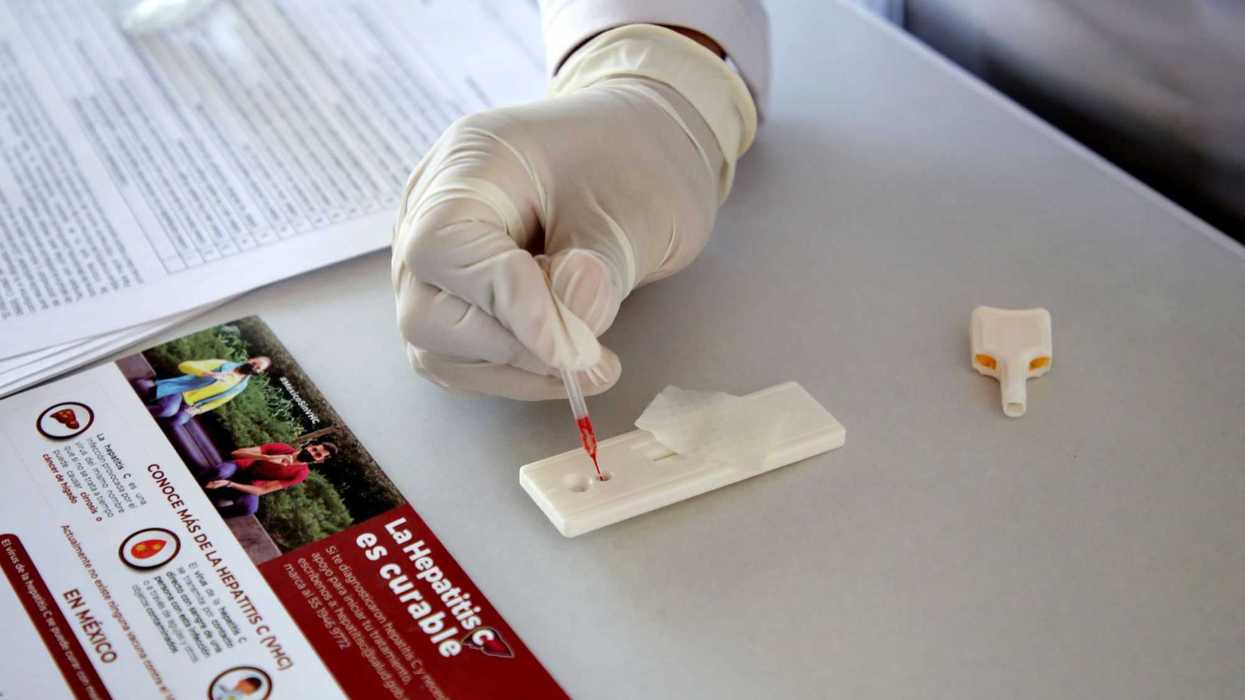 IMSS intensifica esfuerzos en la lucha contra la hepatitis C.