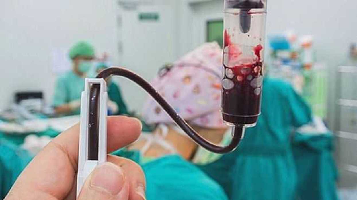 imss-senala-que-la-anemia-no-causa-leucemia