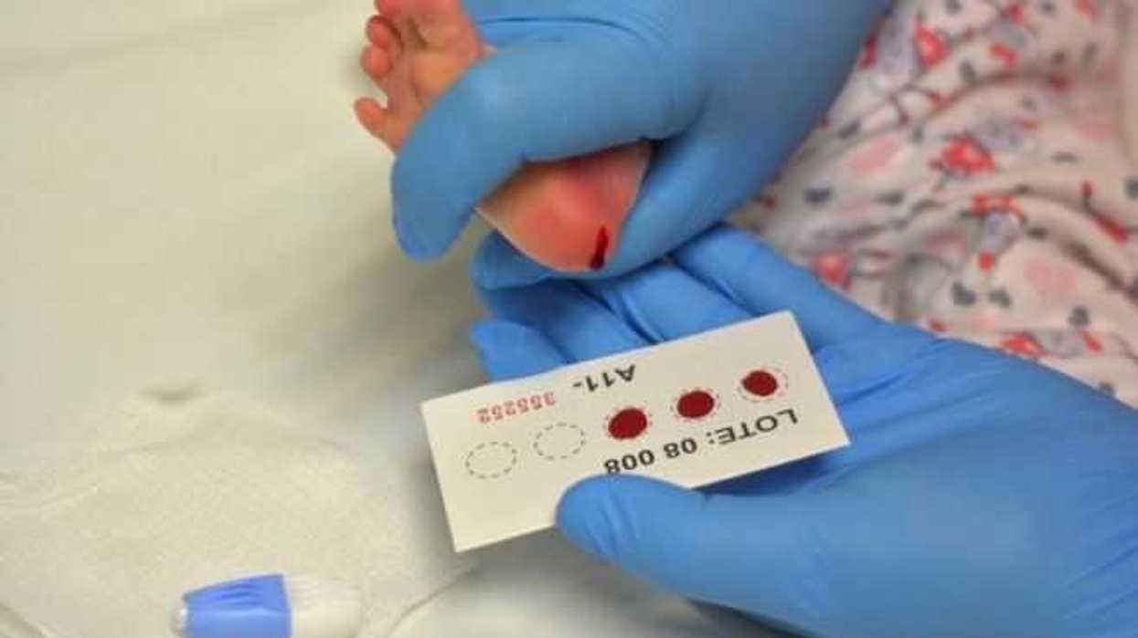 instan-a-realizar-tamiz-para-detectar-a-tiempo-fibrosis-quistica