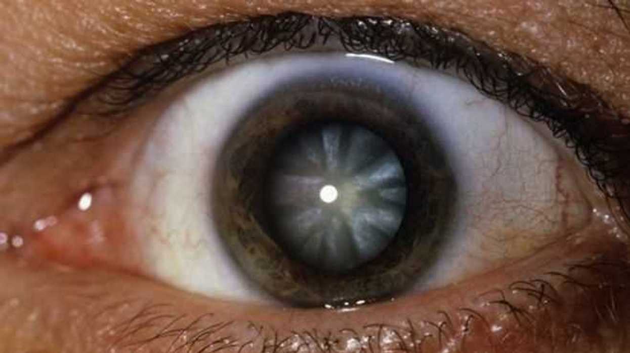 kia-motors-apoya-realizacion-mil-cirugias-cataratas