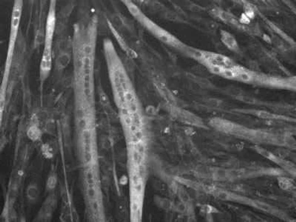 la mitocondria en la ruta hacia tratamientos dirigidos 2