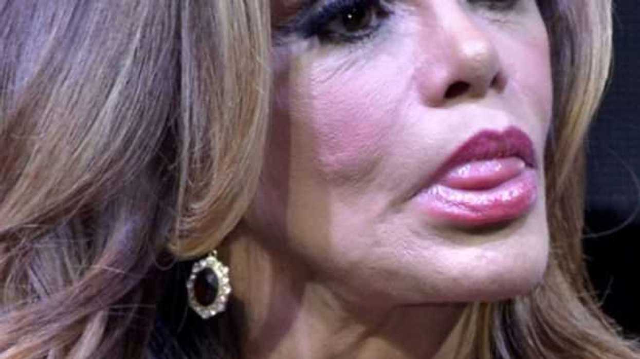 Lucía Méndez y los dramáticos cambios de su rostro.