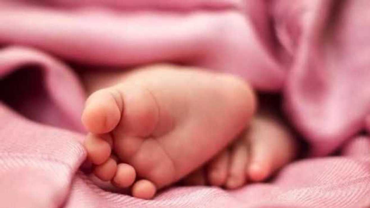 malformaciones-congenitas-principal-causa-de-muerte-neonatal