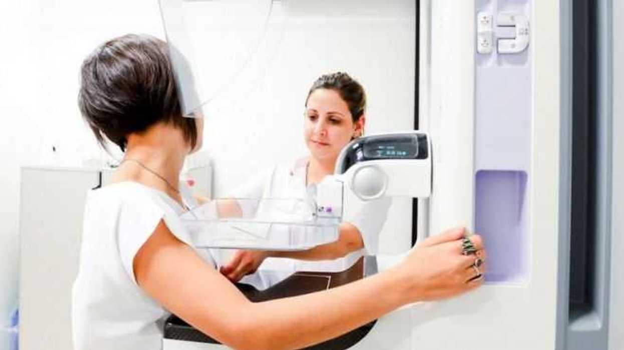 mamografia-unico-estudio-que-reduce-la-mortalidad-por-cancer-de-mama