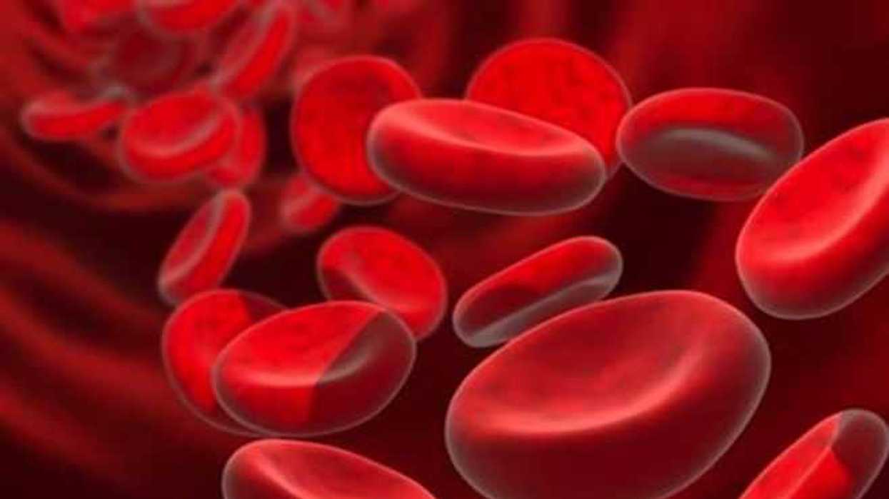 mas-de-30-por-ciento-de-mexicanos-podrian-padecer-anemia-ferropenica