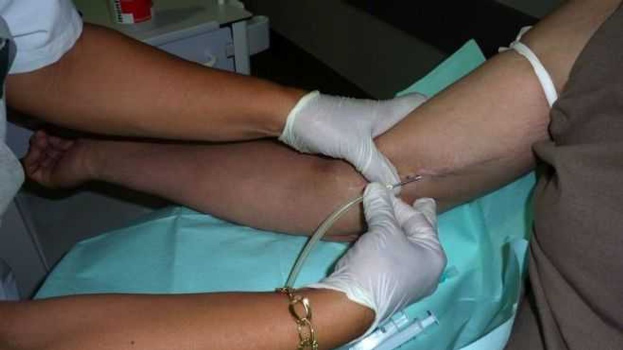 mas-de-la-mitad-de-las-dialisis-se-deben-a-la-diabetes-mellitus