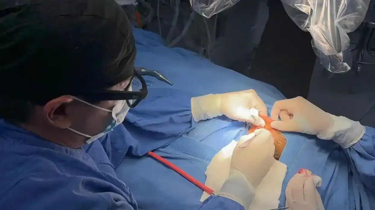 Médico opera durante cirugía de implante coclear en quirófano de la UMAE 71