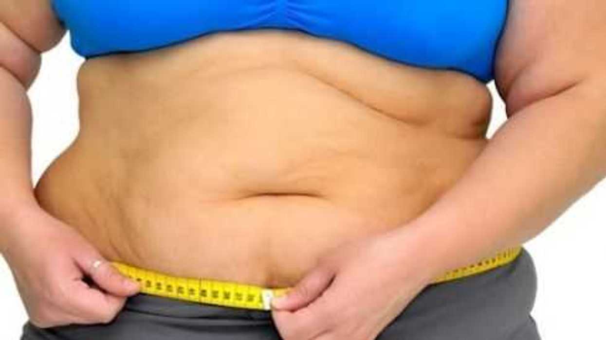 obesidad-edad-y-ser-mujer-factores-de-riesgo-para-osteoartritis