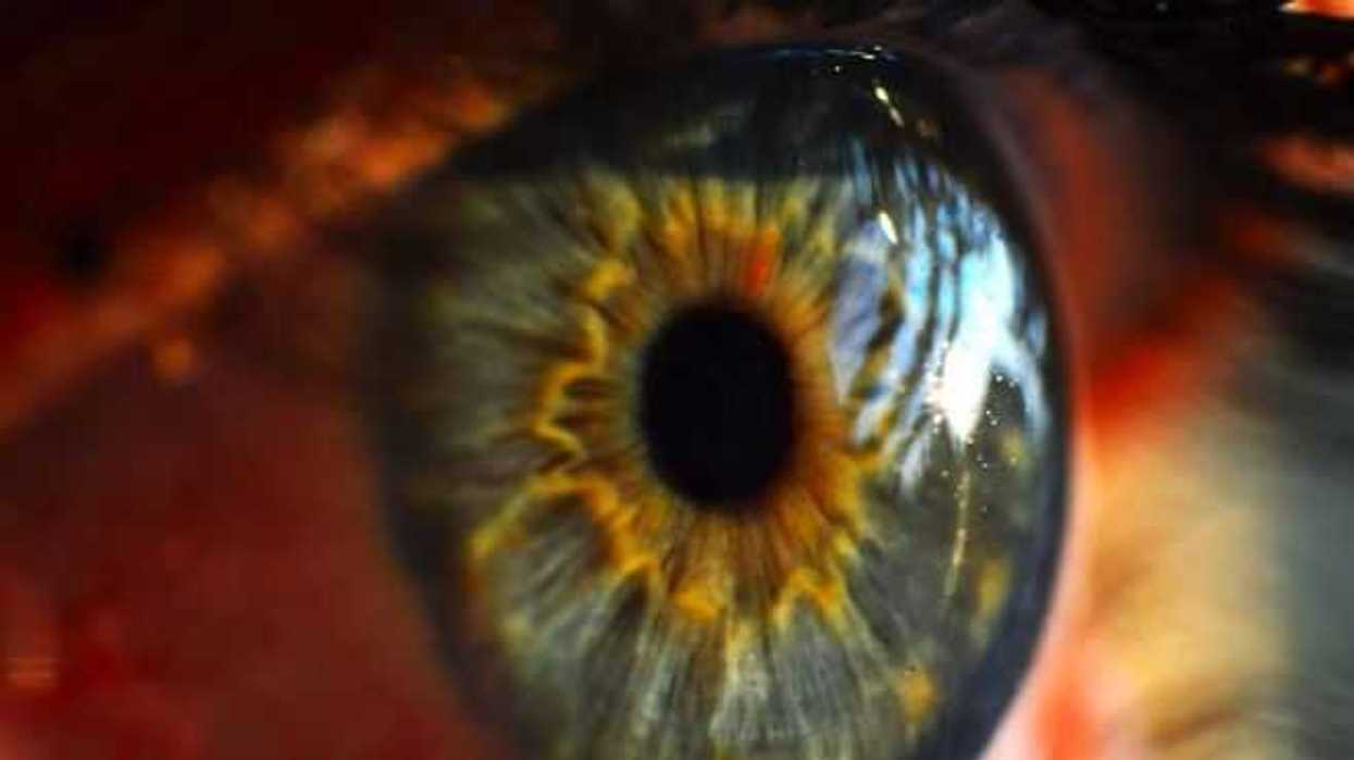 oftalmologo-llama-a-reforzar-cultura-de-donacion-para-trasplante-de-cornea