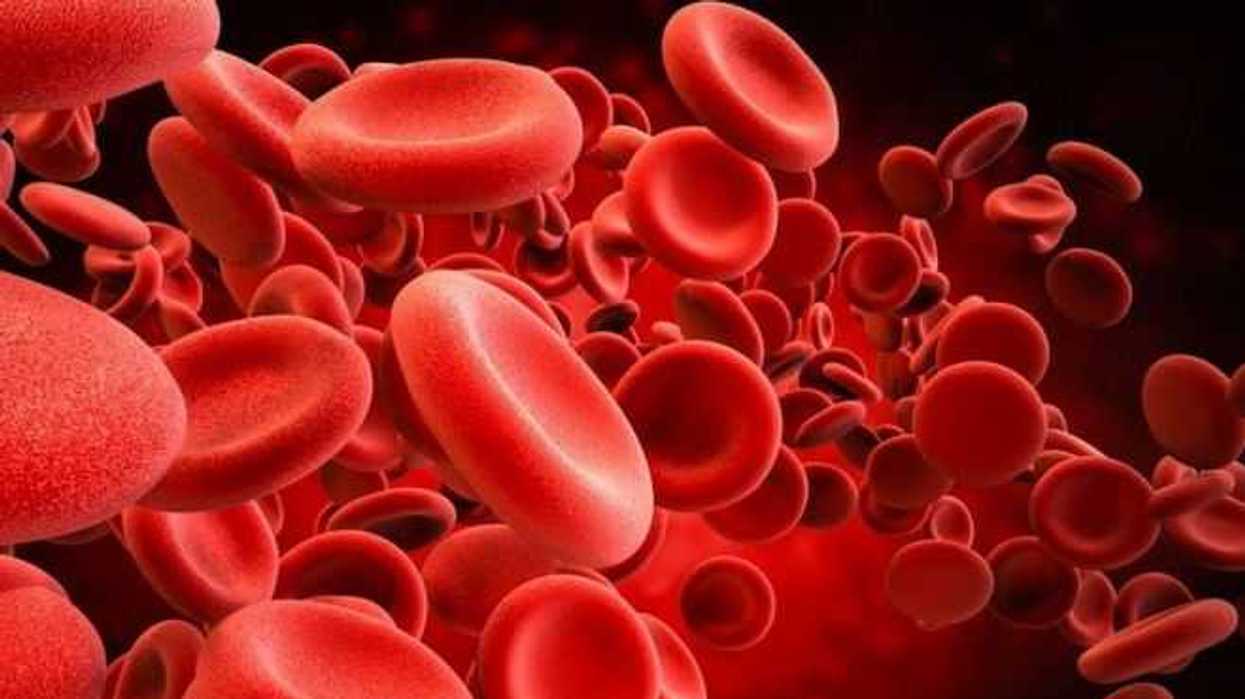 padece-anemia-25-por-ciento-de-la-poblacion-mundial
