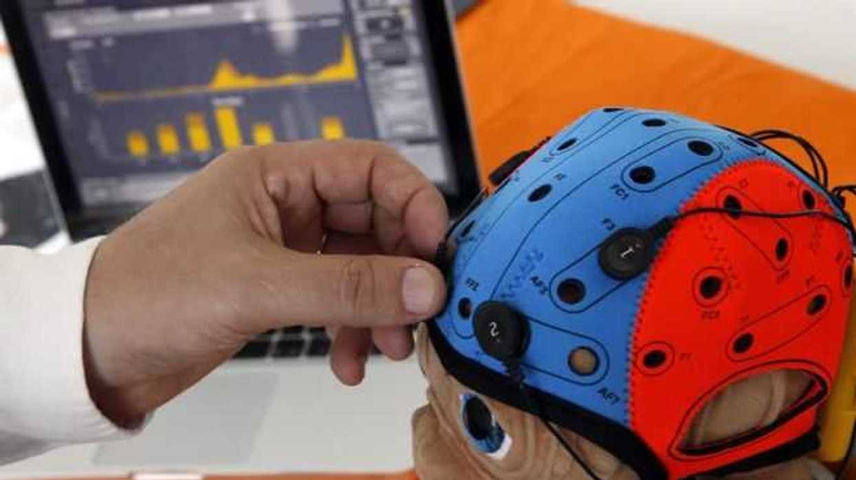 paralisis-cerebral-efe