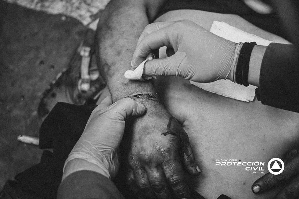 Personal de Protecci\u00f3n Civil limpia y atiende una herida en la mano de un hombre lesionado