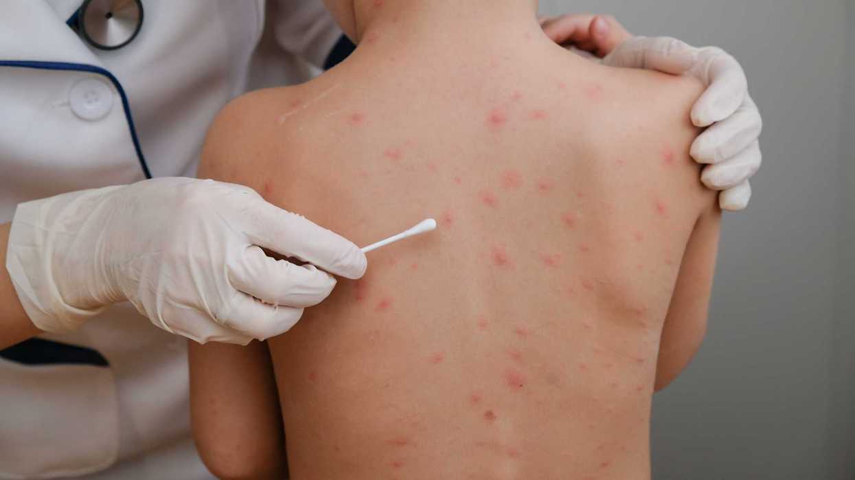 Personal de salud aplica vacuna contra sarampión a menor en centro de salud de Querétaro como parte del programa de inmunización estatal