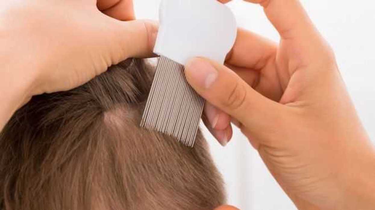 piojos-un-riesgo-para-chicos-y-grandes-en-temporada-de-calor.jpg