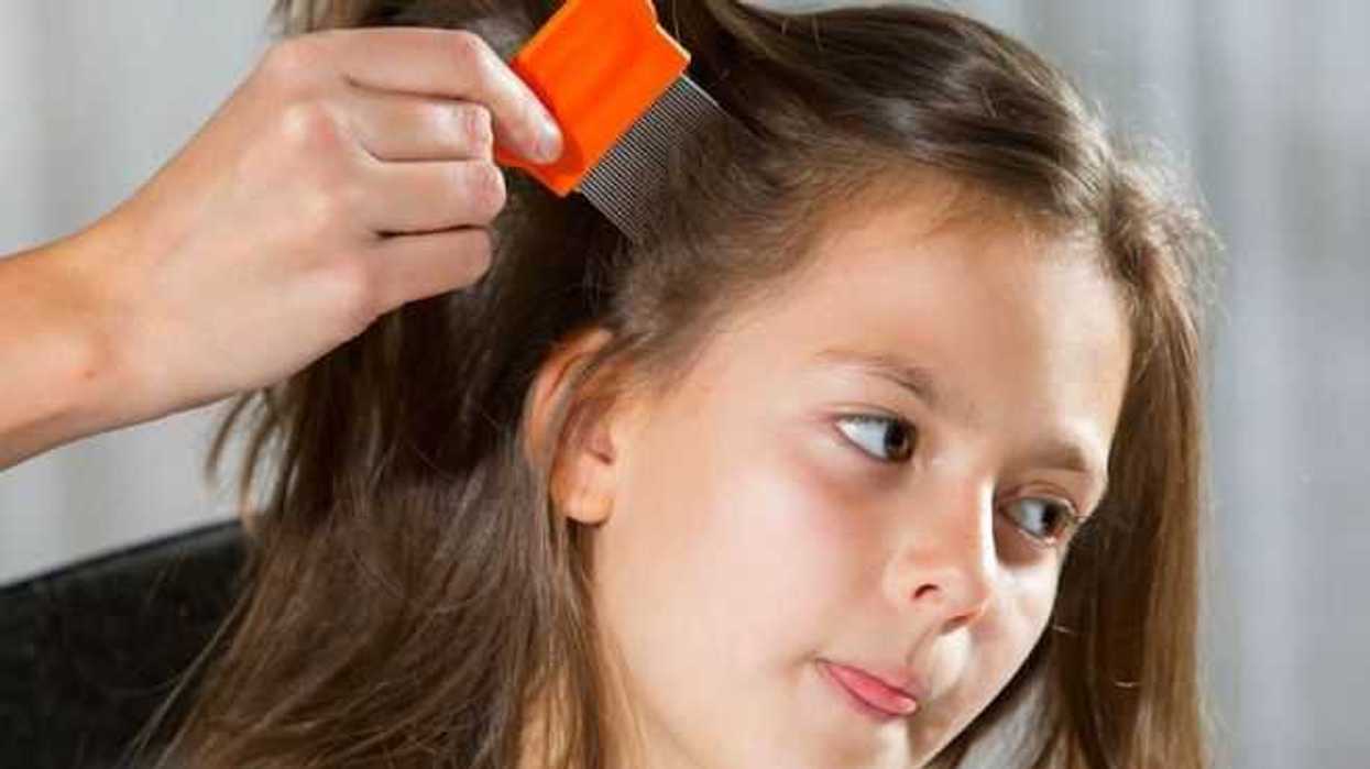 pulgas-y-piojos-del-cuerpo-humano-tambien-propagaron-la-peste-negra