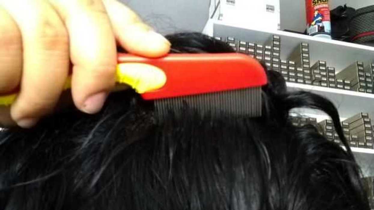 reporta-sector-epidemiologico-400-caso-de-piojos-en-queretaro