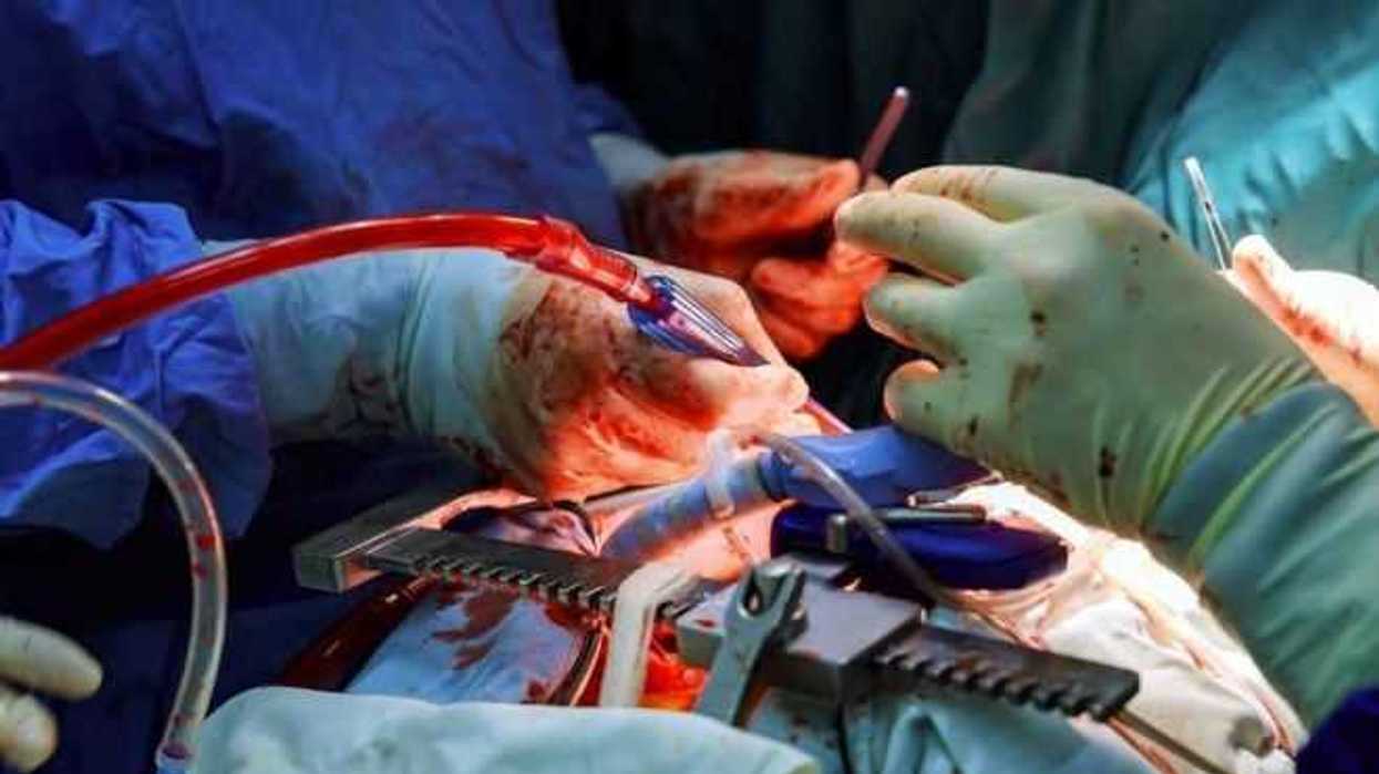 seguro-social-insta-a-la-donacion-de-organos-para-enfermos-renales