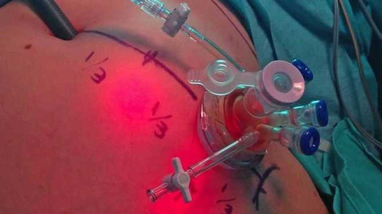 tratamiento-cancer-ovario-gratuito-seguro-popular