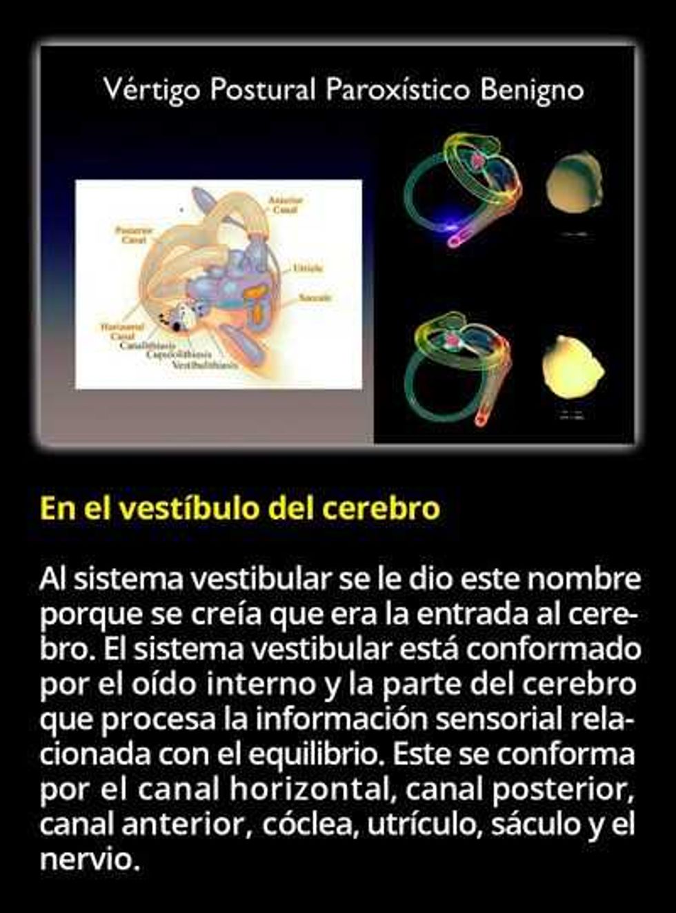 vertigo cuando tu mundo gira sin control 3