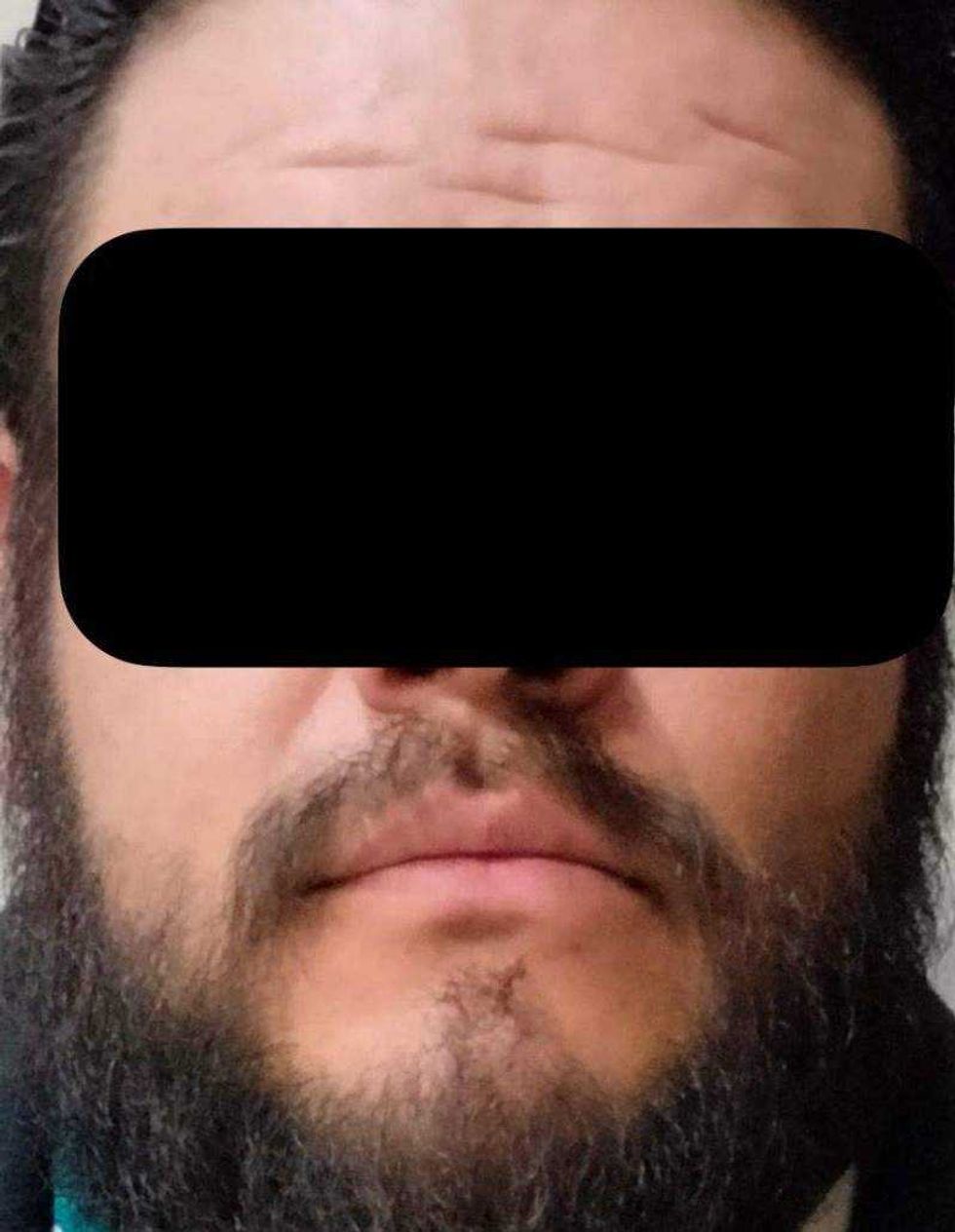 Violencia vial se intensifica: conductor ataca a hombre y le causa daño ocular.