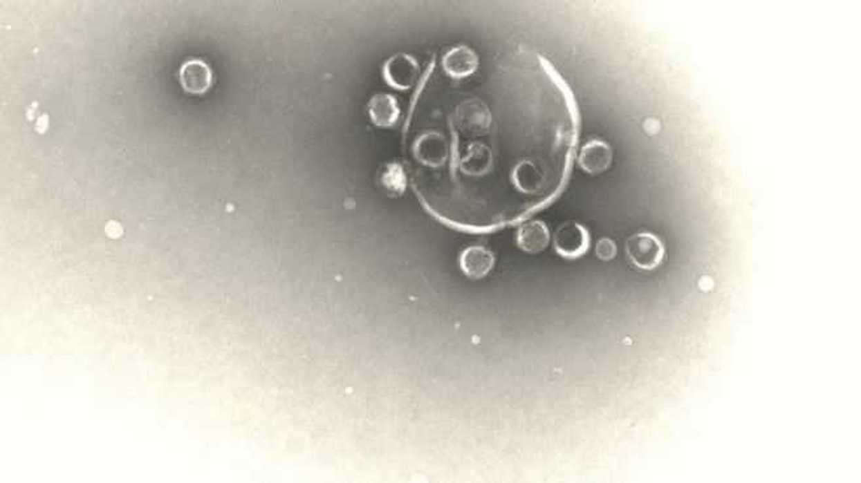 virus-investigacion-efe